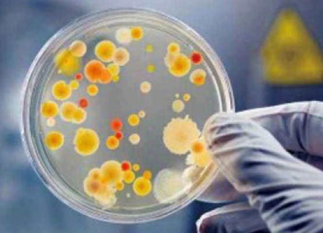 ԭλ�л���Ⱦ԰���޸�- ǿ��΢�����޸�